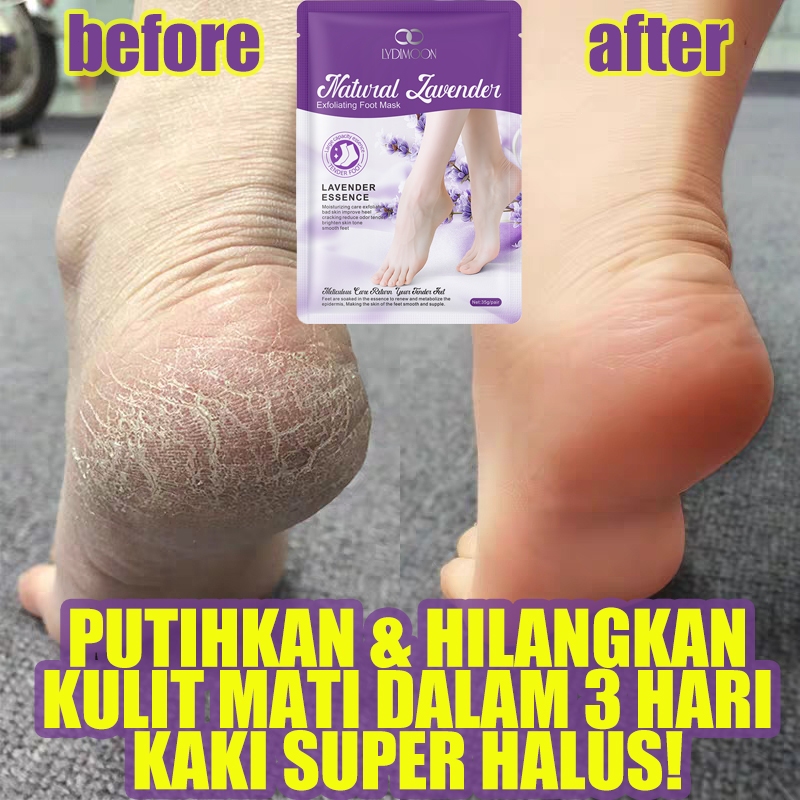 Masker kaki Masker kaki pengelupas kulit mati Hilangkan kulit mati Putihkan Ekstrak lavender