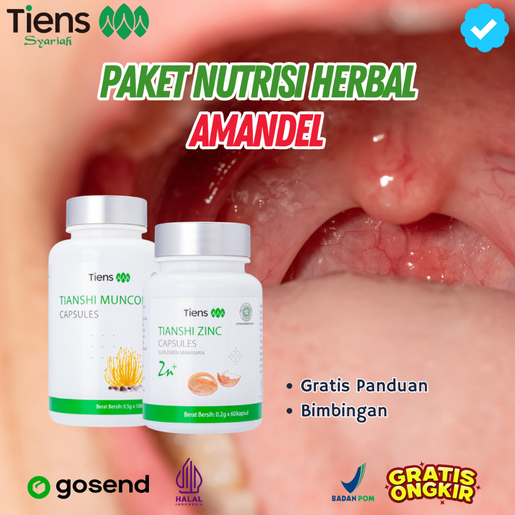 TIENS Tcm Herbal China Amandel Sakit Radang Obat Tenggorokan Fitofarmaka Bpom Halal Original
