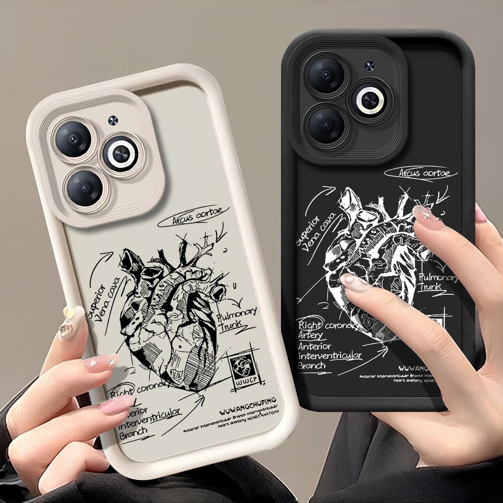 Softcase timbul Tecno Spark 20 Spark 20c - Case Hp Tecno Spark 20 Spark 20c - Casing Tecno Spark 20 