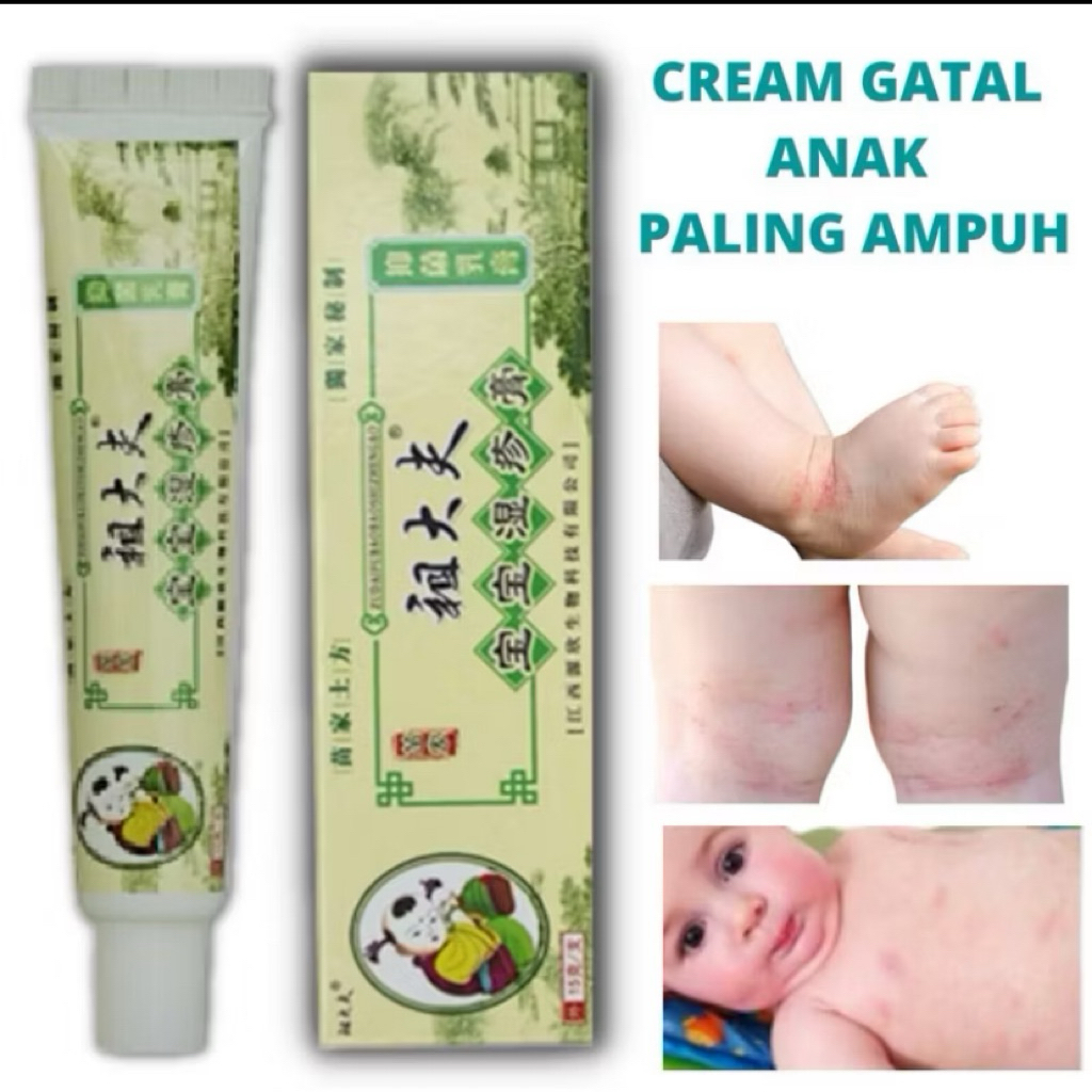 KA salep anak-anak balita bayi salep kulit gatal paling ampuh salep kulit ekstrim gatal selangkangan