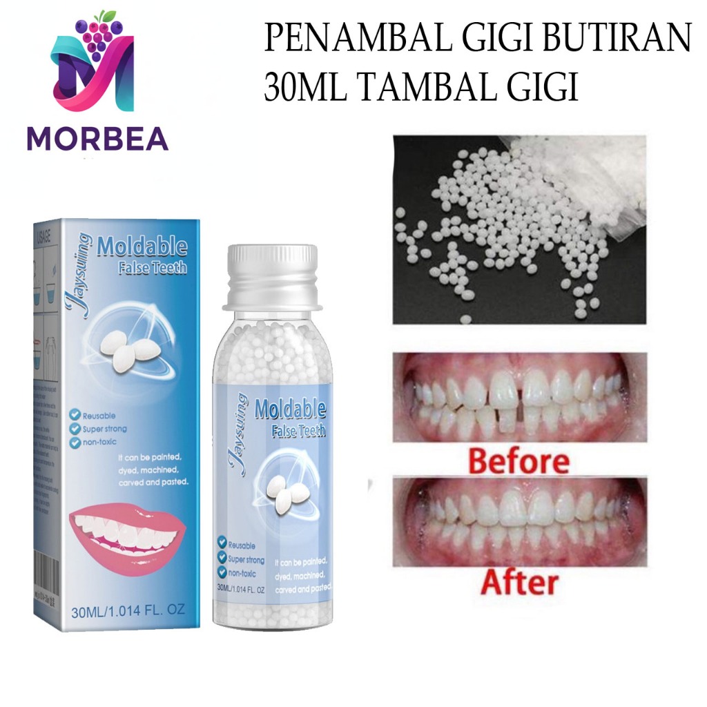 GIGI PALSU 400 BUTIR / PENAMBAL GIGI PATAH RENGGANG TEMPORARY TOOTH TEMPTOOTH GINGSUL PATAH KELINCI