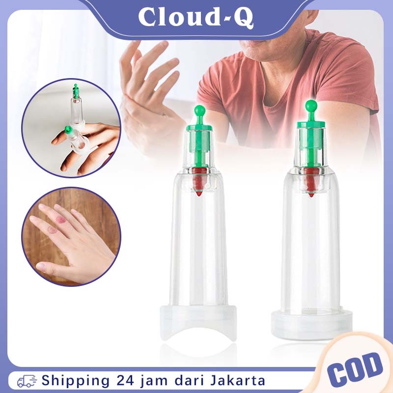 Bekam Kop Angin / Alat Bekam Jari Curve Flat / Alat Bekam Kop Bekam Vakum