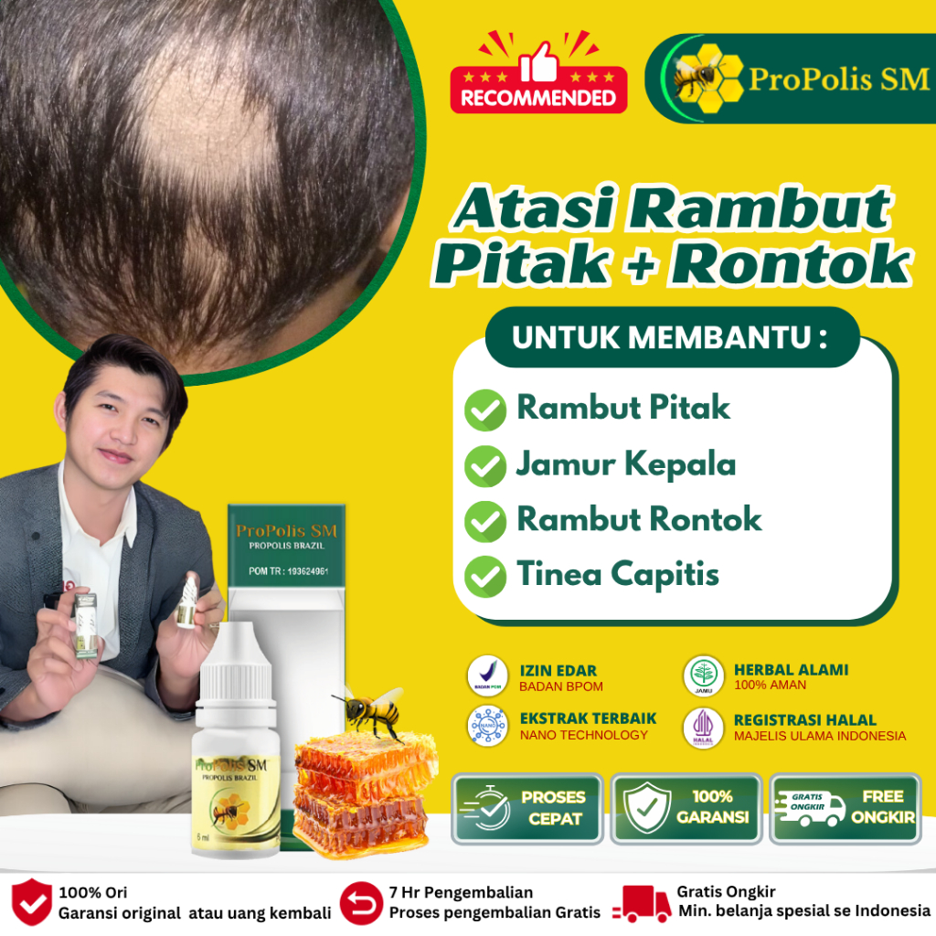 Obat Penumbuh Rambut, Penumbuh Rambut Cepat Serum Penumbuh Rambut Pitak, Obat Kepala Pitak, Obat Ram