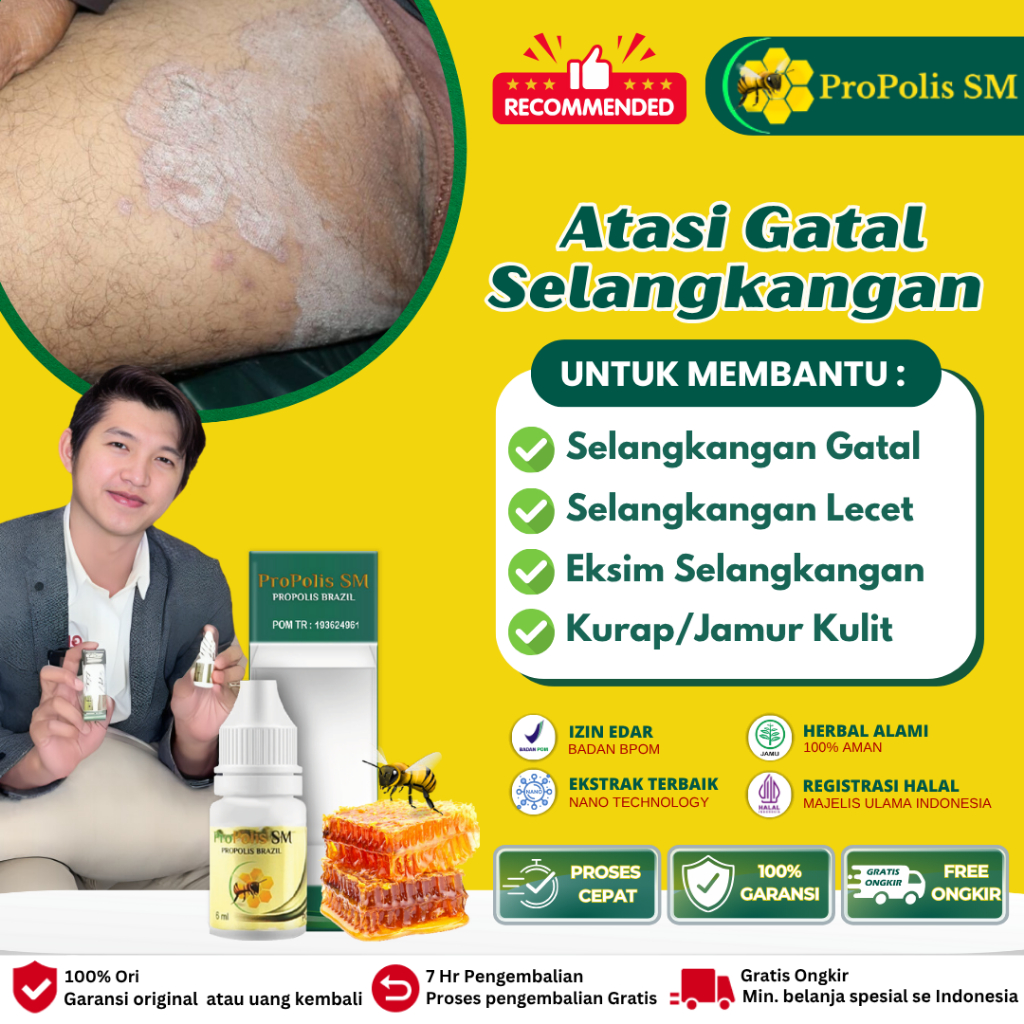 Obat Gatal Selangkangan Berjamur, Obat Tinea Cruris Selangkangan Gatal Berjamur Selangkangan Hitam, 
