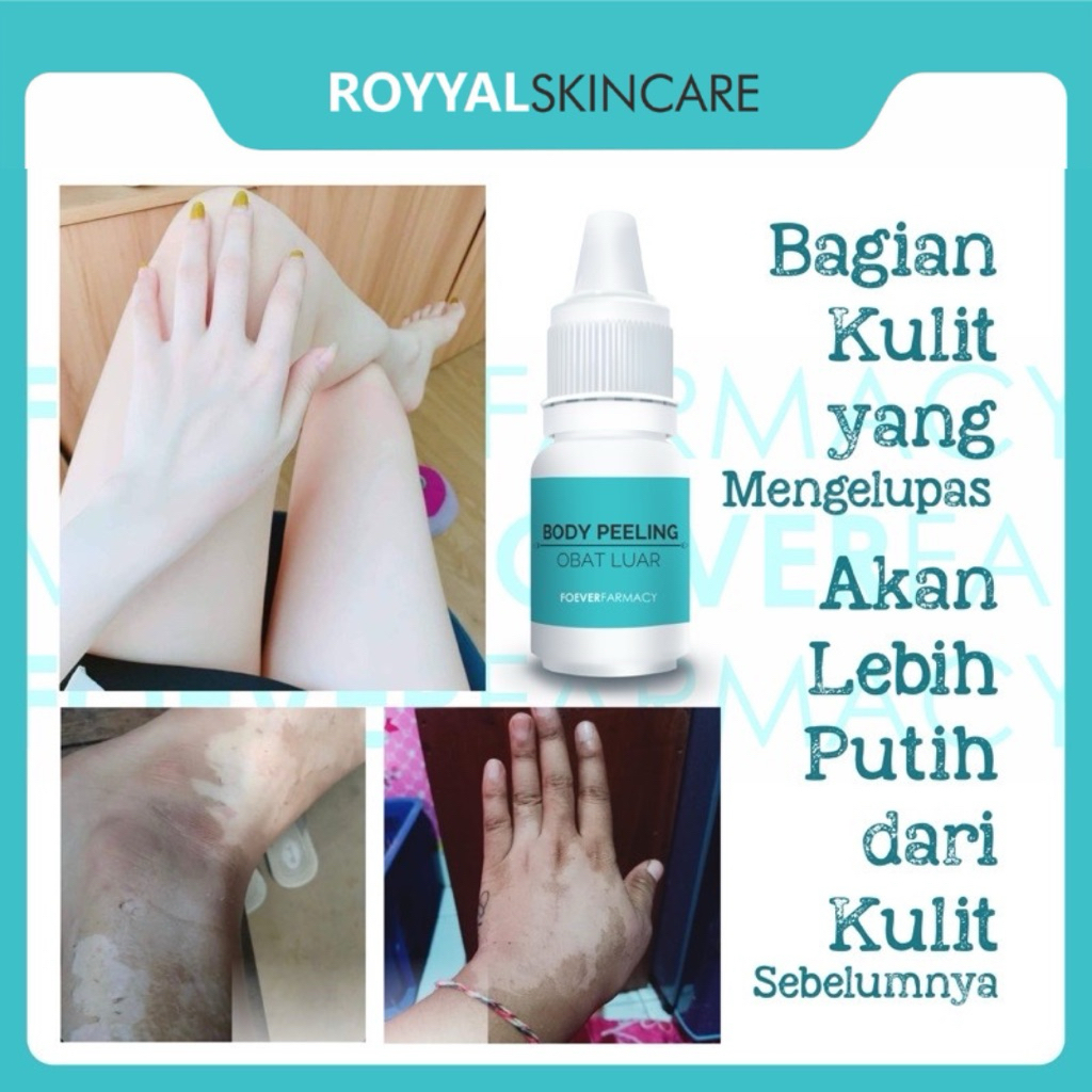 dr.Titik Wahyuningsih PEELING PENGELUPASAN AMPUH | LOTION PEMUTIH | PEMUTIH BADAN | BODY PEELING | P