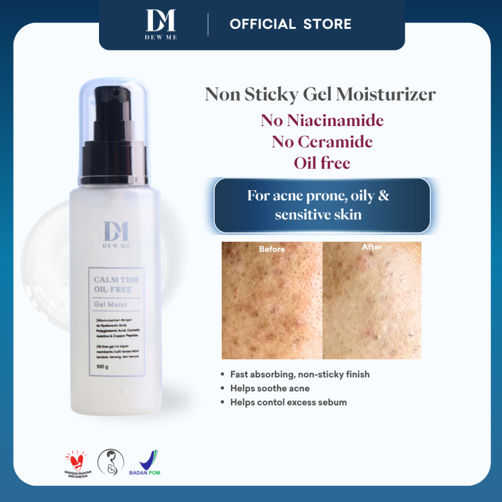 Dew Me Calm Tide Gel Moisturizer Acne Prone Oily Sensitive Skin No Ceramide No Niacinamide Oil Free