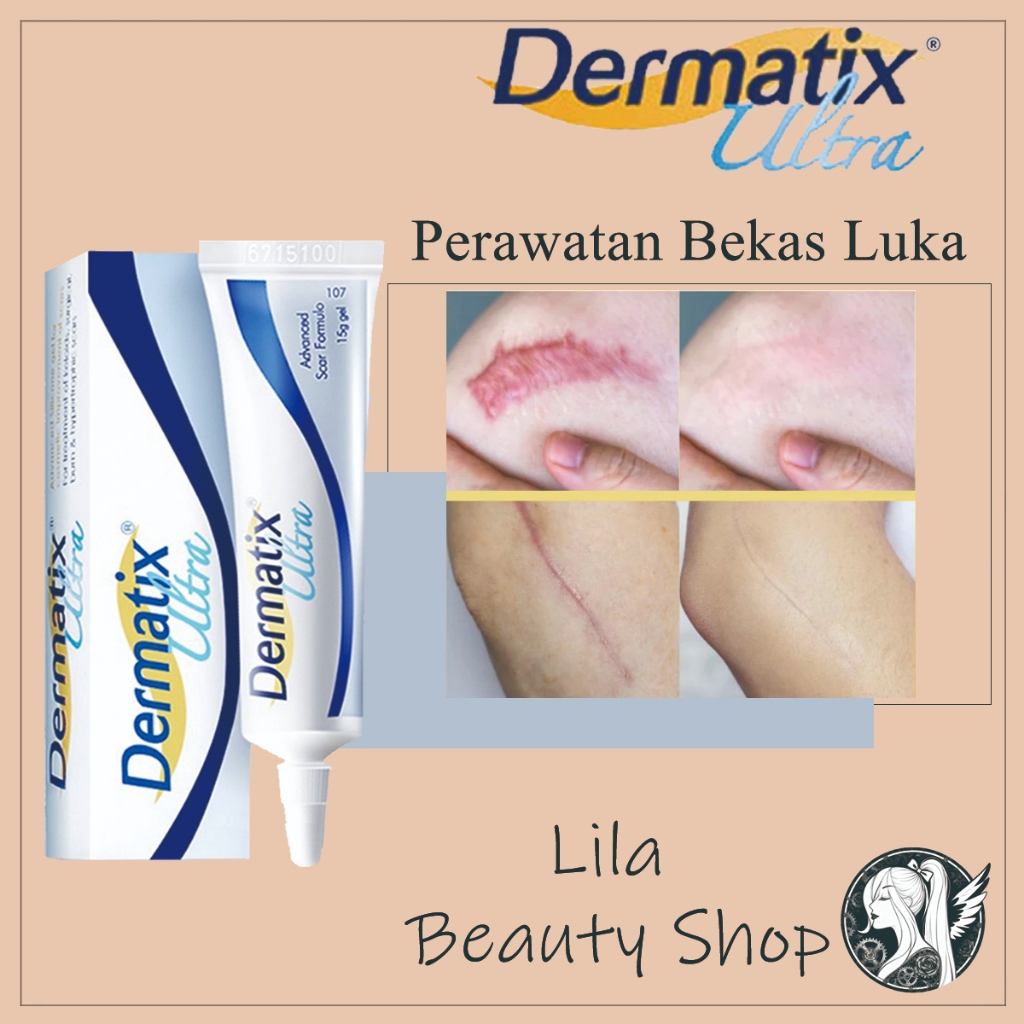 [100% asli] Dermatix Ultra 15gr - Merawat dan memudarkan Bekas Luka