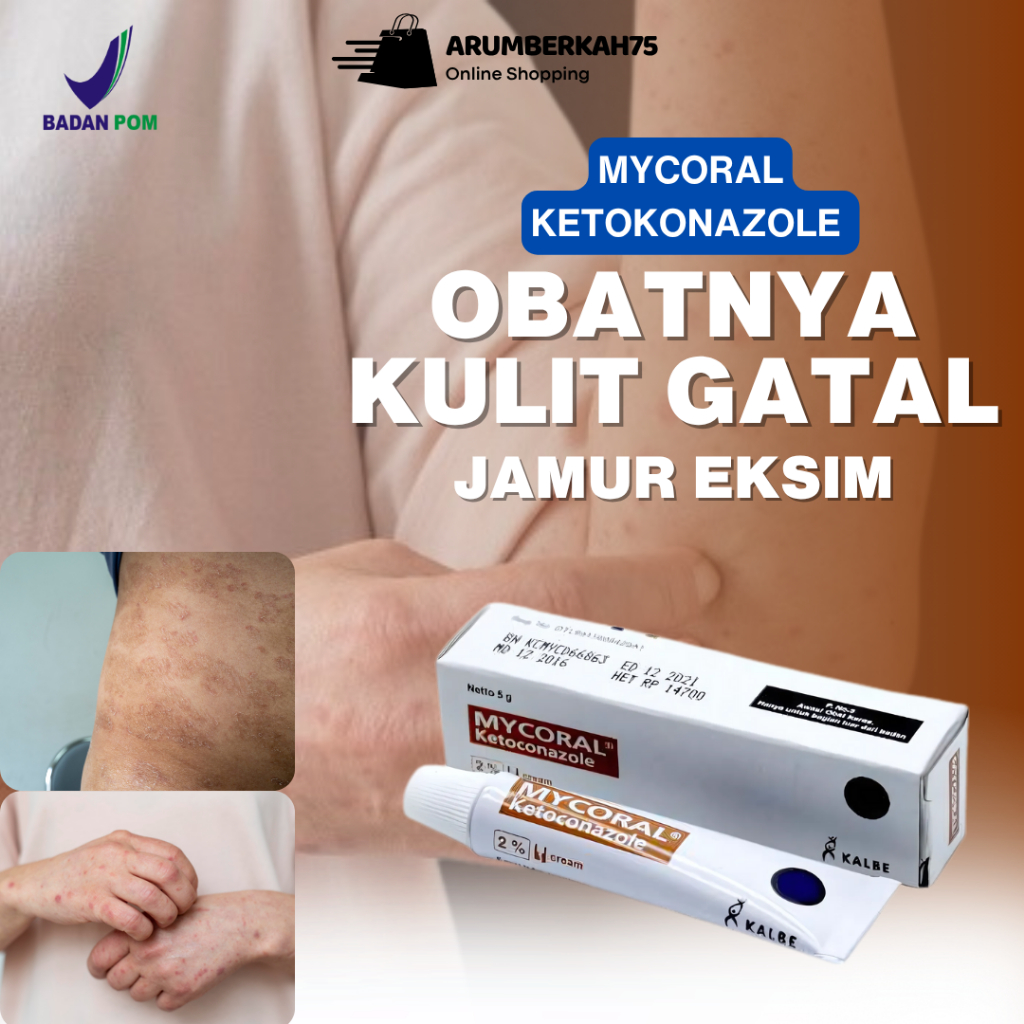 Mycoral Cream 5 gram - Obat Kurap Panu Kadas Salep Gatal Kutu Air Jamur Kulit Di Tangan Ampuh Bpom