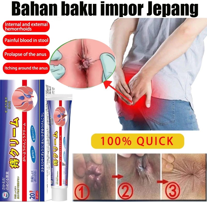 Krim Wasir Herbal Ampuh 20g Jepang Salep ambeien paling ampuh 20g Meredakan ketidaknyamanan wasir Fo