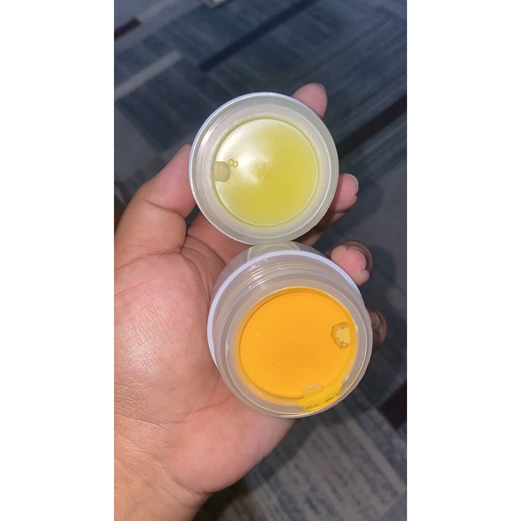 DAY & NIGHT HC FARMA SKINCARE || JERAWAT RINGAN,BEKAS JERAWAT,FLEK,MEMUTIHKAN ALL SKIN