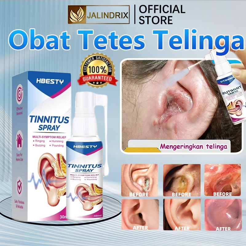 Jalindrix Obat tetes telinga pembersih kotoran obat sakit telinga pembersih telinga bayi anak 30ML t