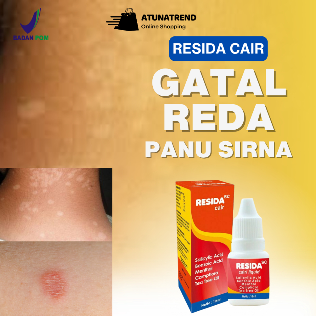 Obat Penghilang Panu Resida Ampuh untuk Panu Kadas Kurap Jamur Kulit Cepat Sembuh Ampuh Bpom