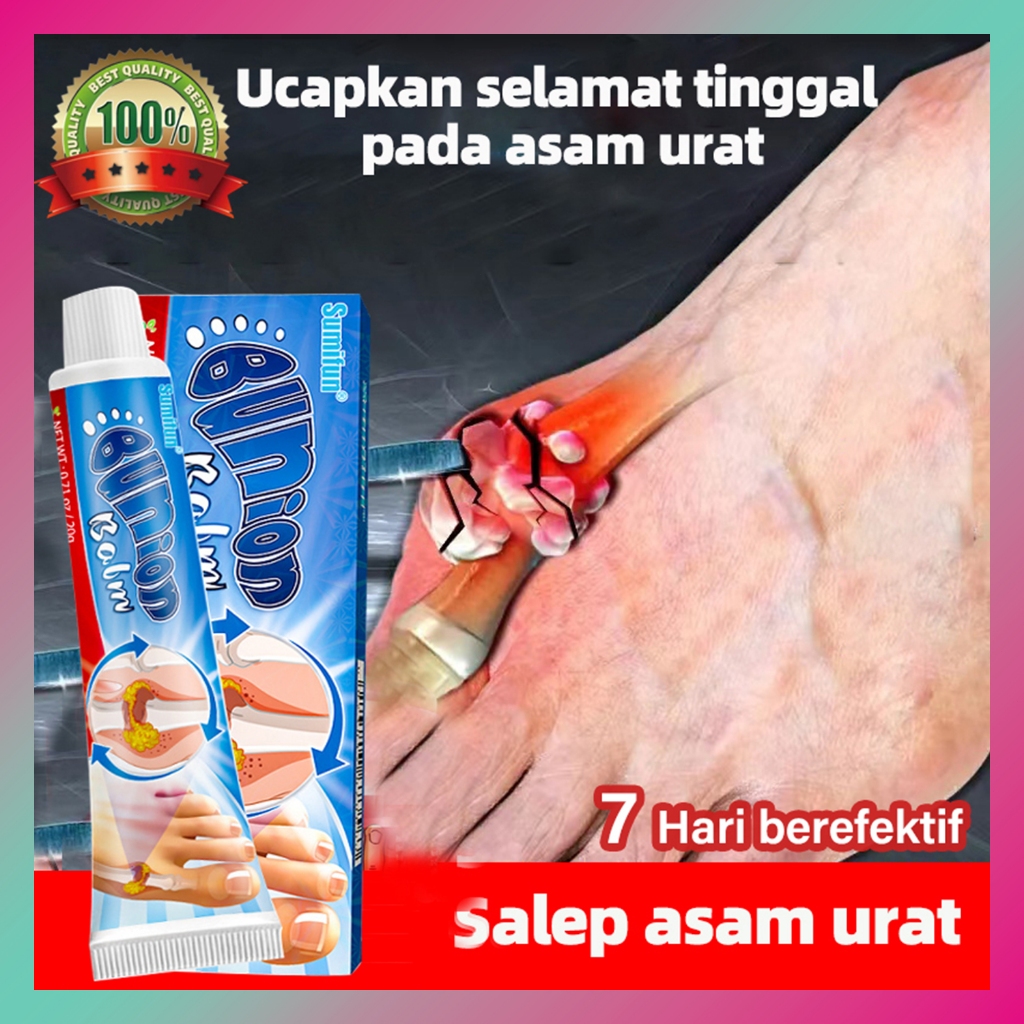 Salep nyeri sendi asam urat, obat asam urat, salep artritis, obat nyeri sendi rematik