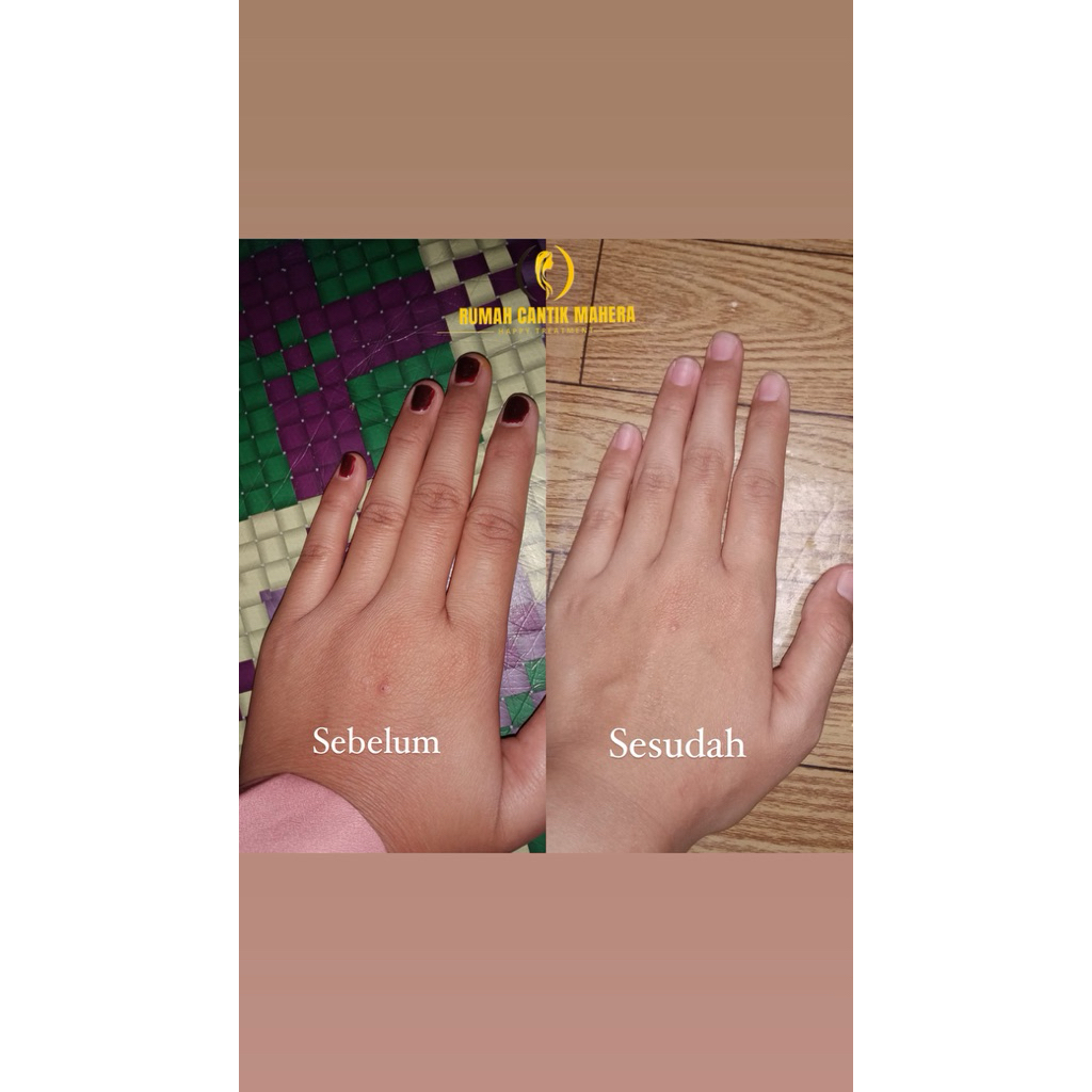 Body Peeling