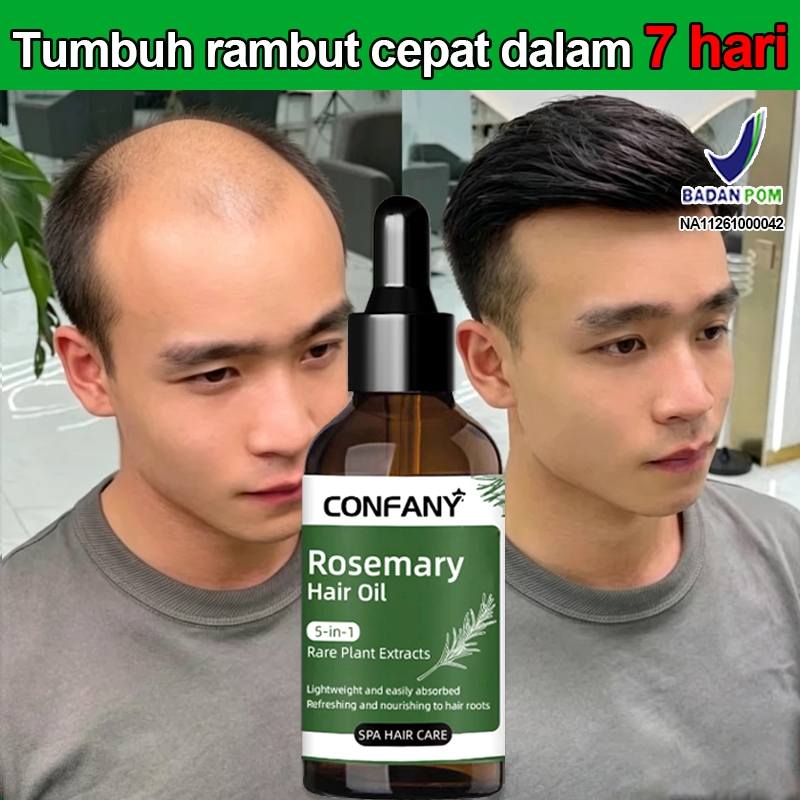 Rosemary Oil Rambut Hair Serum Penumbuh Rambut Cepat Dan Tebal Minyak Penumbuh Rambut Cepat Penebal 