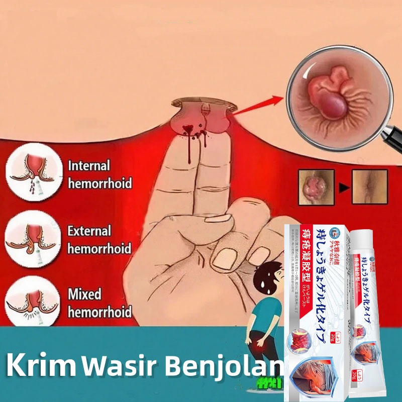 Obat Wasir Salep Wasir 20G Hemorrhoids medicine Menghilangkan Benjolan dan Meredakan Sakit Wasir Oba