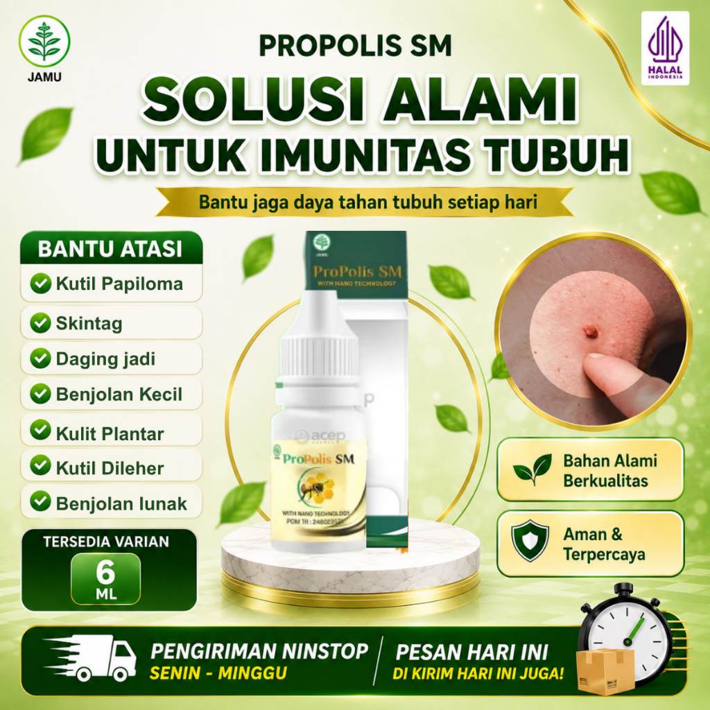 Obat Papiloma Di Leher, Obat Tetes Papiloma, Obat Penghilang Papiloma, Obat Papiloma Di Wajah, Obat 