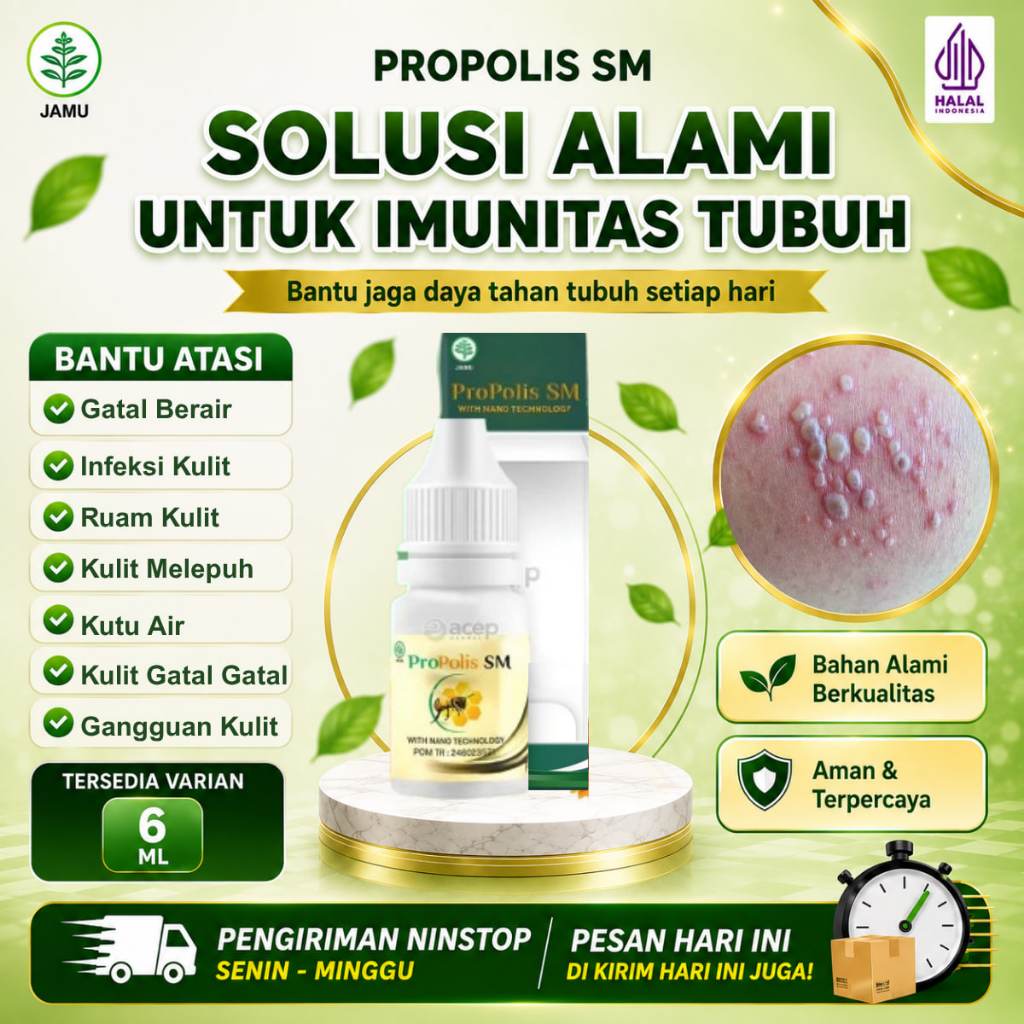 Obat Tetes Gatal Berair, Gatal Bintik Berair, Kutu Air, Gatal Bening Kulit,  Gatal Berair Di Tangan 