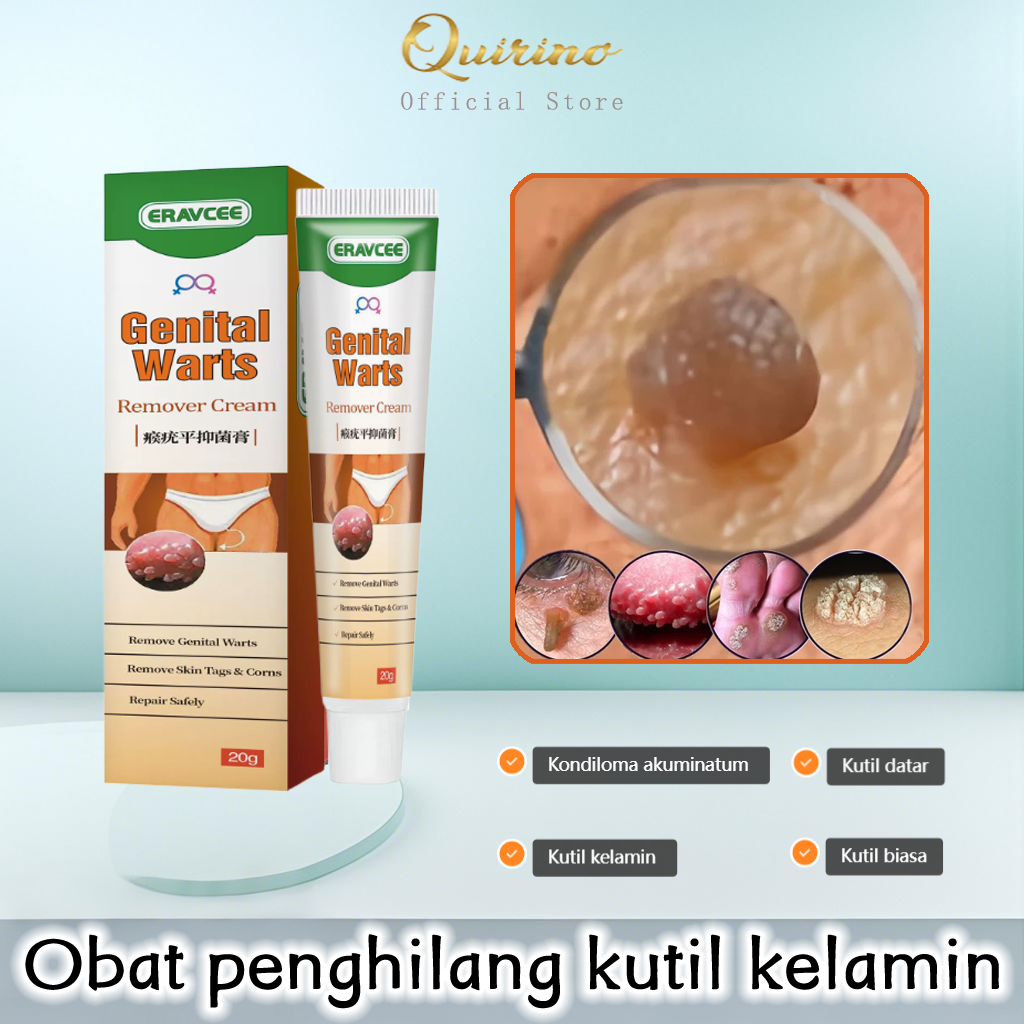 Quirino Obat kutil kelamin Penghilang Kutil Kelamin Obat Kutil Kelamin HPV Penghilang kutil dan tahi