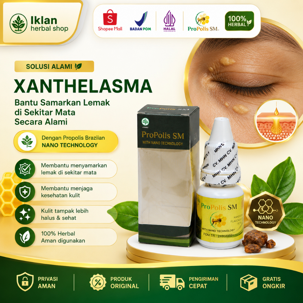 Obat Penghilang Xanthelasma Di Kelopak Mata Dengan Propolis SM