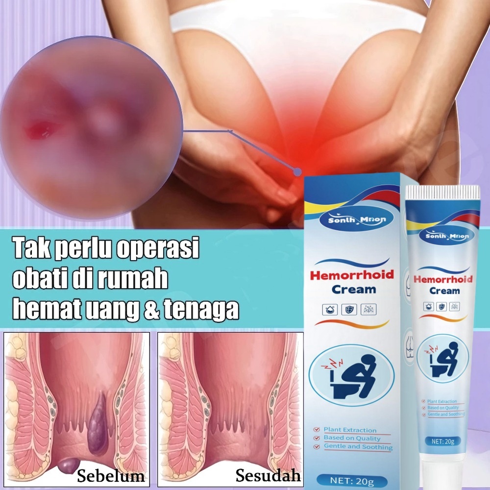 Obat Wasir Salep Wasir 20G Hemorrhoids medicine Menghilangkan Benjolan dan Meredakan Sakit Wasir Oba