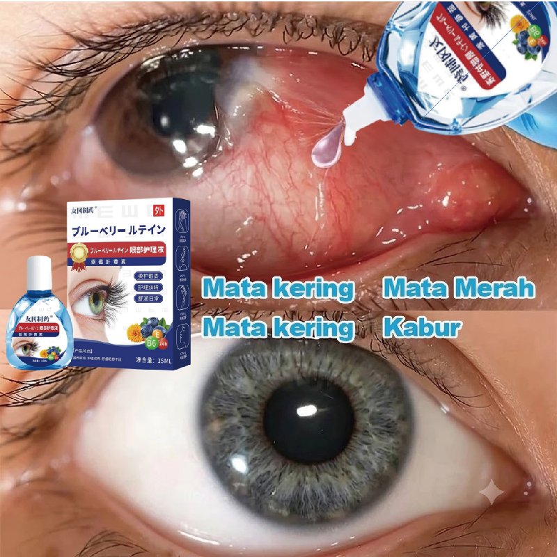 Lutein Obat Tetes Mata tetes mata kering tetesmata cendo xitrol Merah Gatal Belekan Rabun
