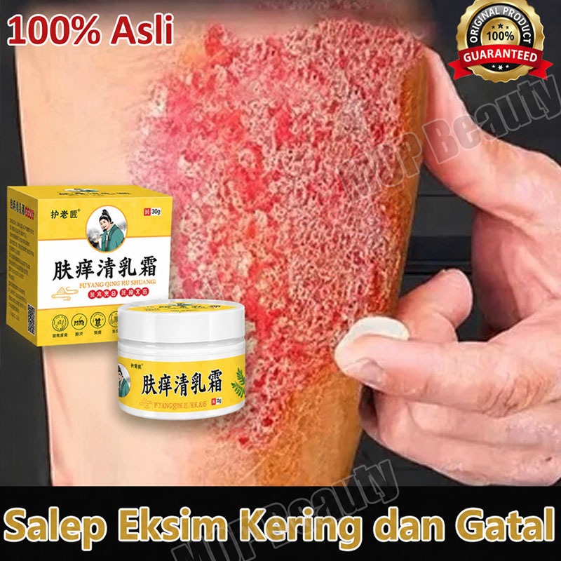 Salap gatal china obat gatal selangkangan salep eksim kering dan gatal obat eksim psoriasis cream Me