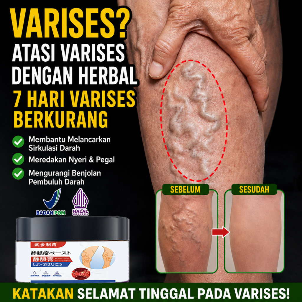 Obat varises salep varises cream varises paling ampuh original obat varises paling ampuh salep varis