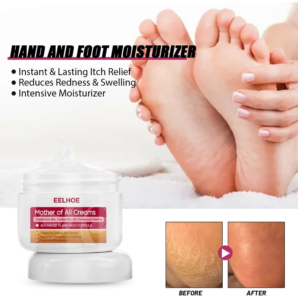 EELHOE Hand Foot Cream 30ml Melembabkan Dan Mengurangi Gatal Hand And Foot Moisturizer Cream Kaki Pe