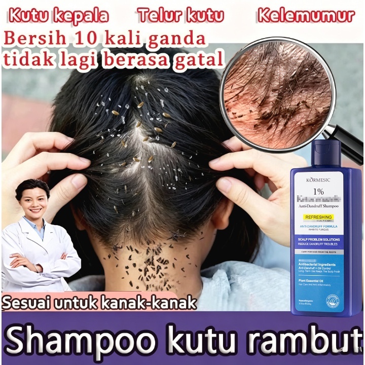 ketoconazole shampoo shampoo psoriasis kulit kepala shampoo anti dandruff penghilang ketombe paling 