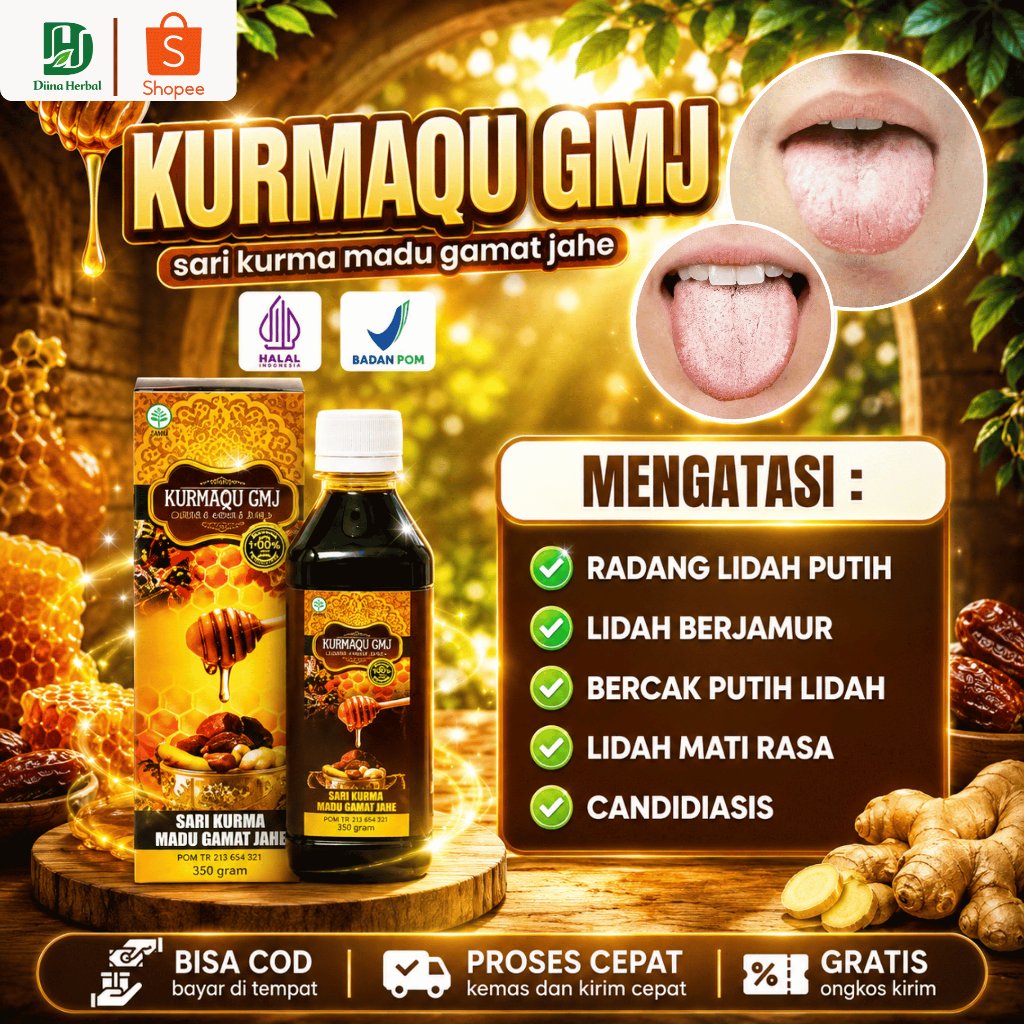 Obat Radang Lidah Putih, Obat Lidah Putih Berjamur, Obat Bercak Putih di Lidah Anak dan Dewasa, Obat