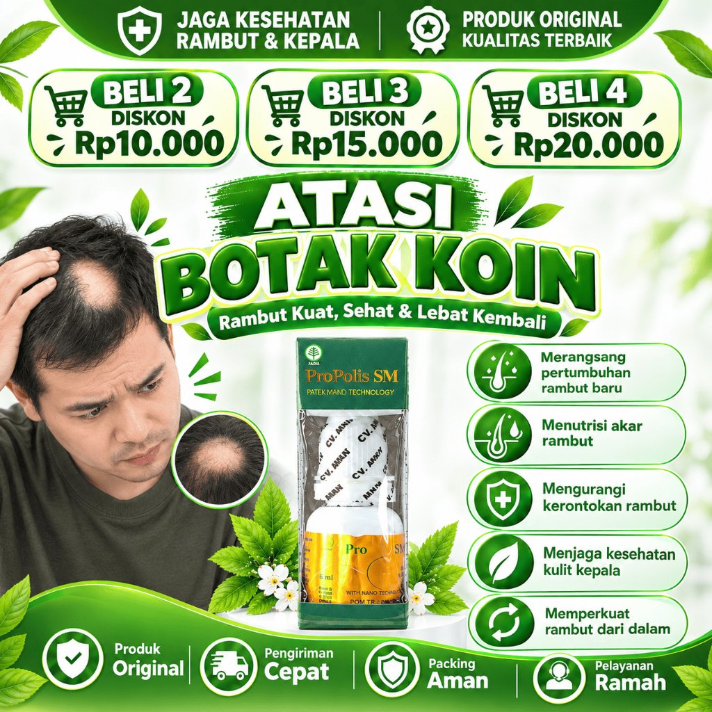 Obat Alopecia Areata Botak Koin Tinea Capitis Rambut Pitak Kerontokan Penyakit Autoimun Jamur Kepala