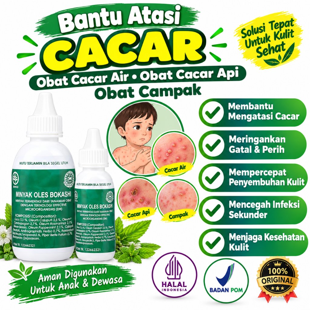 Obat Cacar, Obat Cacar air, Obat Cacar Api, Obat Campak