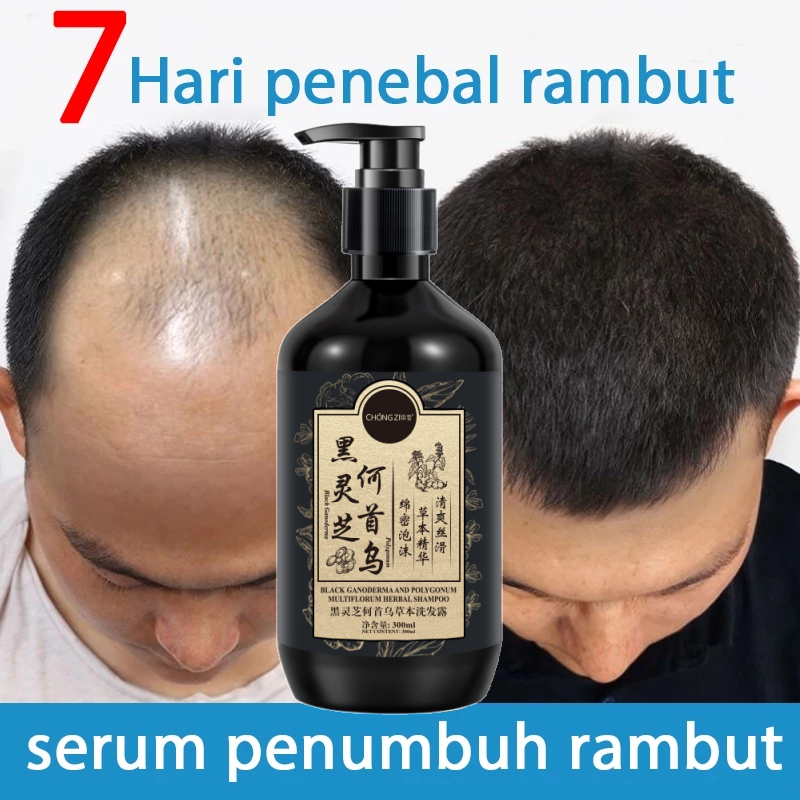 shampoo penumbuh rambut cepat Ginger Shampoo shampoo penumbuh rambut Shampoo Anti Rontok shampoo ram
