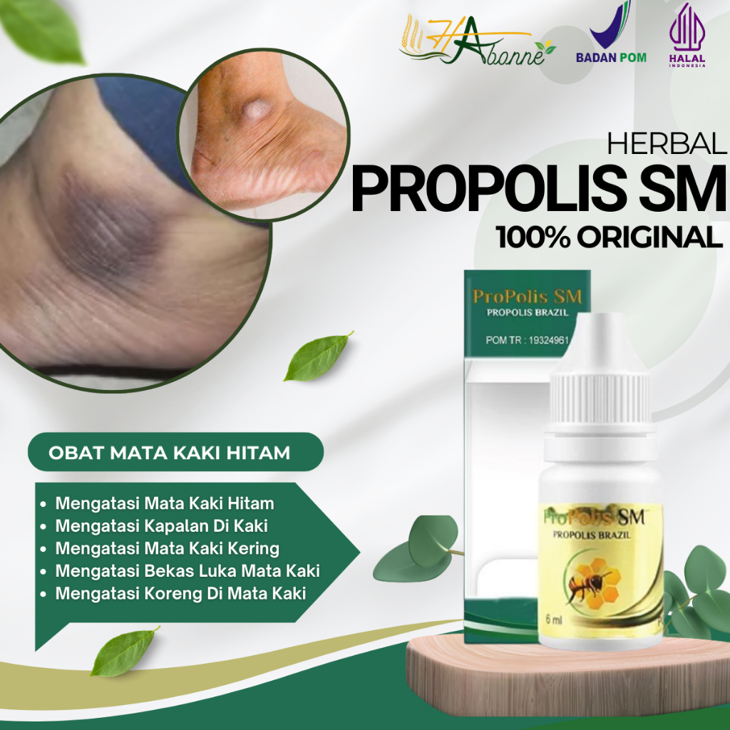 HAbonne - Obat Mata Kaki Hitam, Penghilang Hitam Di Mata Kaki, Kapalan Kaki Tebal, Mata Kaki Hitam D