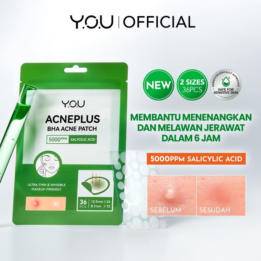 YOU AcnePlus BHA Acne Patch Jerawat 5000 ppm Salicylic Acid 36 PCS