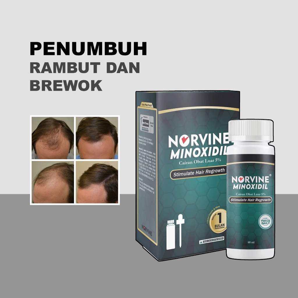 Minoxidil Norvine 5% Original Penumbuh Brewok Alis Rambut Jenggot Kebotakan