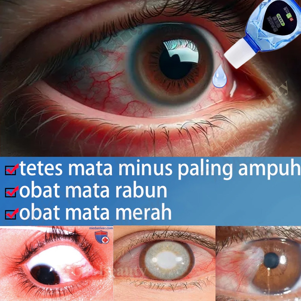 Tetes Mata Mata Katarak Tetes Mata untuk Penglihatan Kabur Astigmatisme Miopia Eye Drop Tetes Mata K