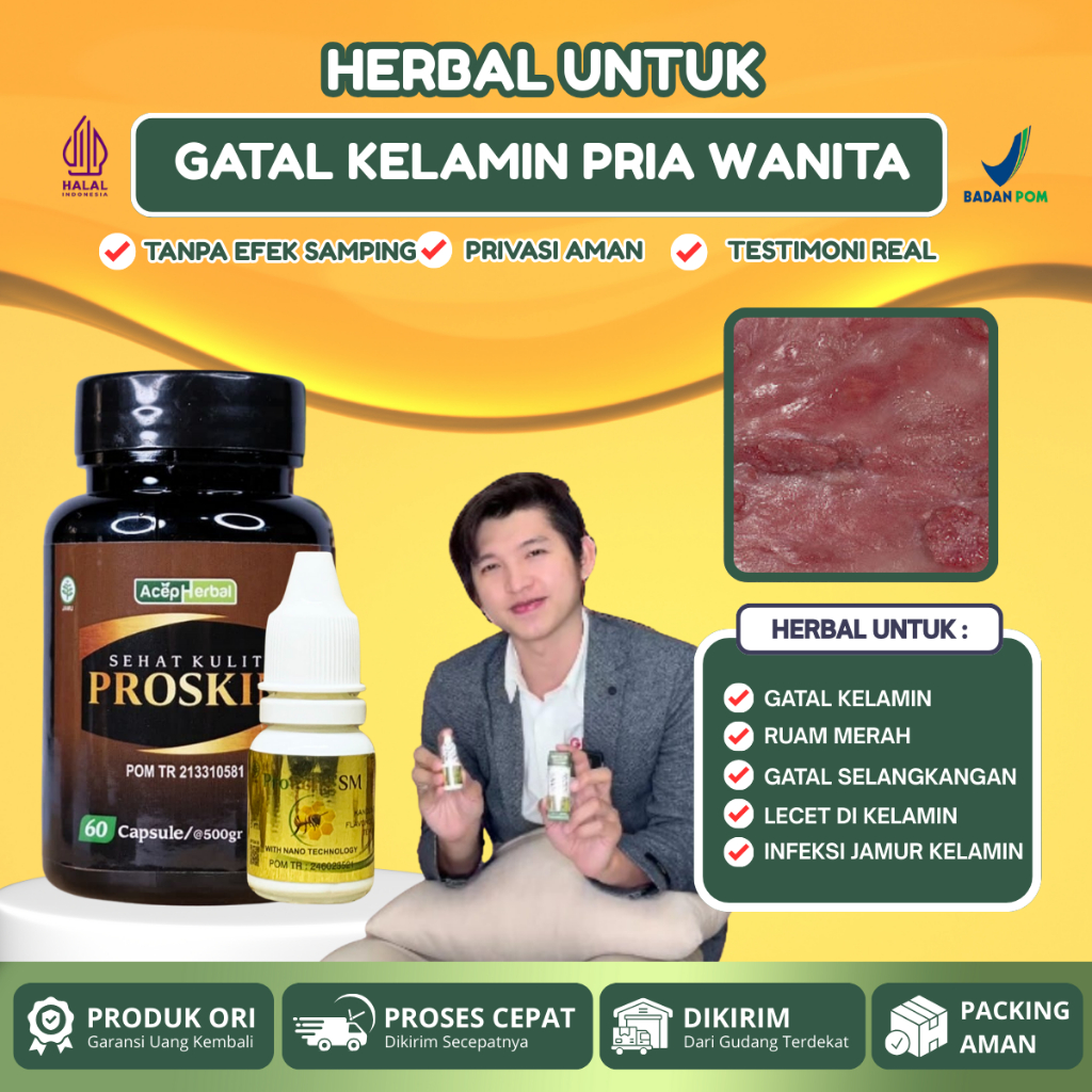 Obat Gatal Kelamin gatal lecet miss v Infeksi jamur kelamin, Bintik Ruam Merah Gatal pada kelamin