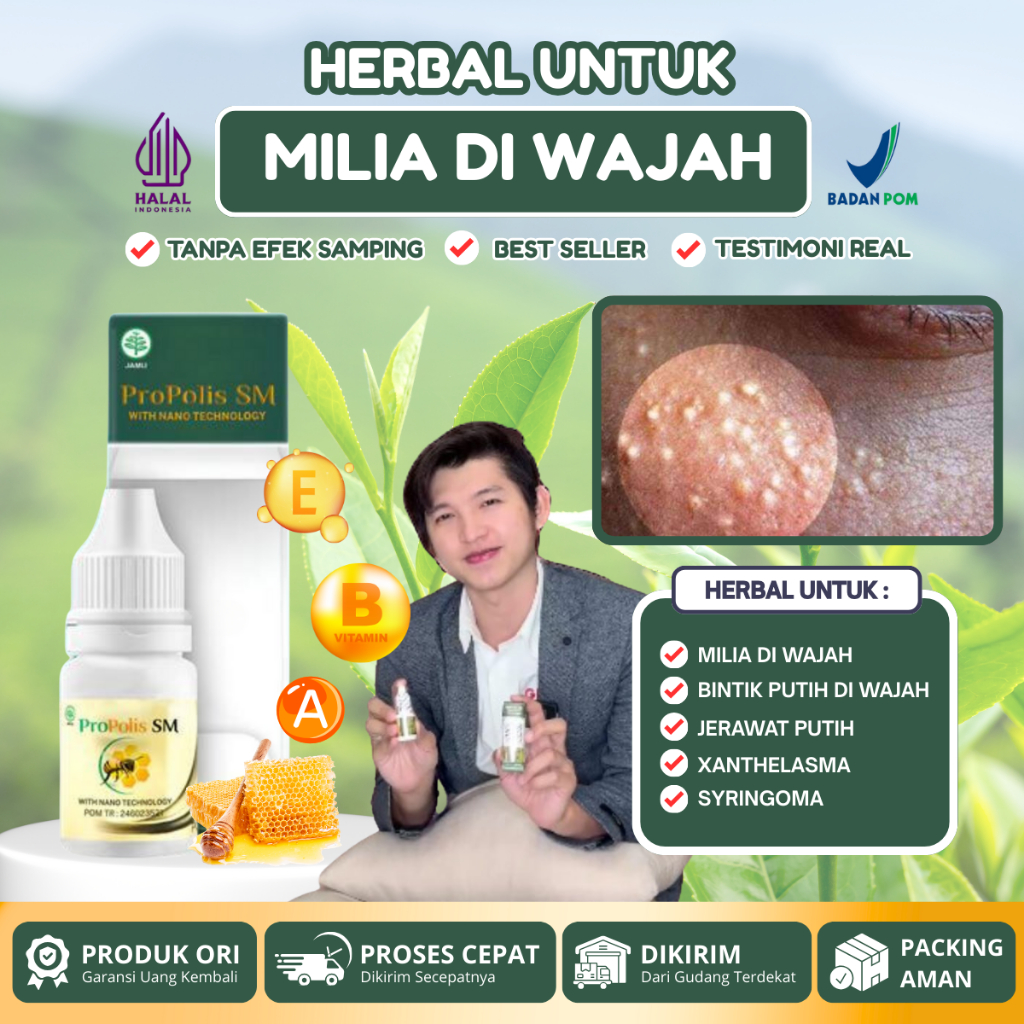 Obat Milia di Bawah Mata, Pembersih Bintik Putih Xhantelasma / Syringoma di Wajah Bawah Mata