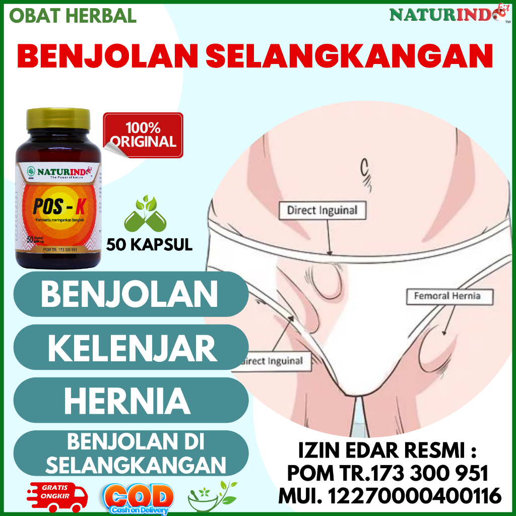 Obat Benjolan Di Selangkangan Pria Wanita Herbal Sekelan Kelenjar Lipoma Selangkangan Pangkal Paha