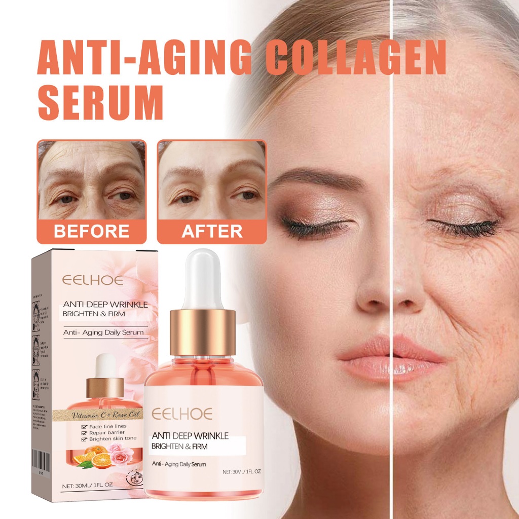 Skin Wart Care Cream Repair Removes Warts On Head Neck Smooths Skin Improves Obvious Warts Krim Pera