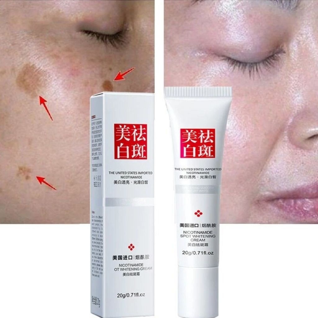 fuyan  whitening freckle cream remove dark spots