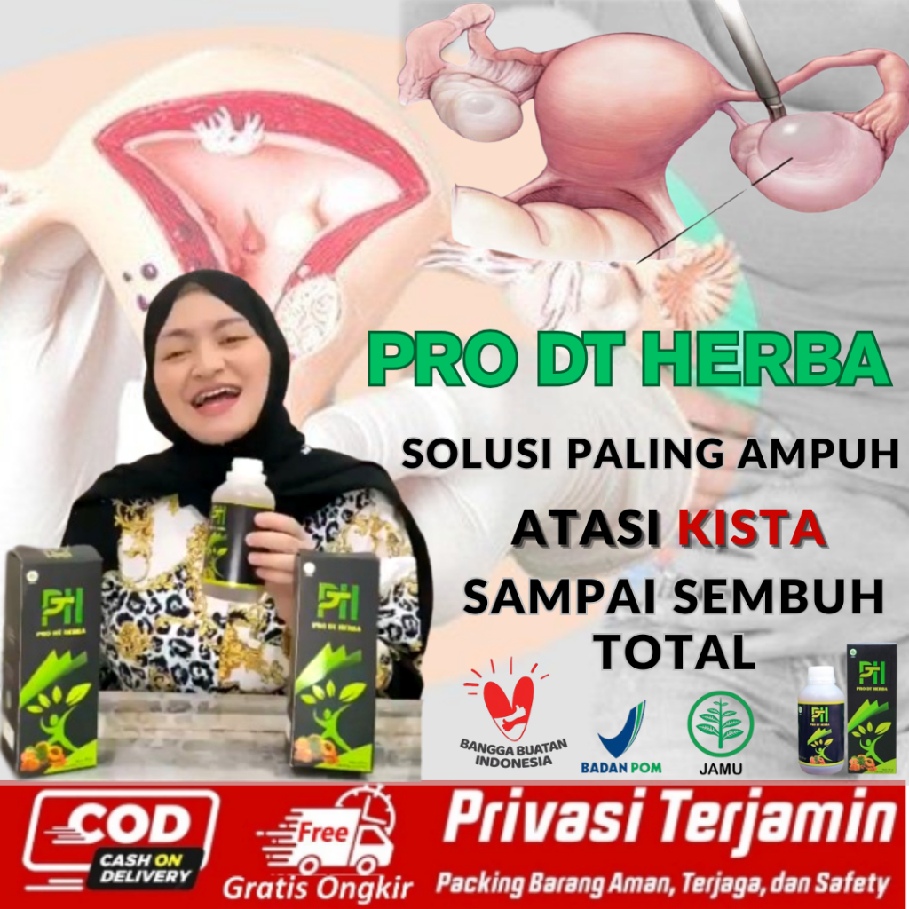 obat Kista Ovarium, Kista Bartholin, Kista Epidermoid, Kista Endometriosis, Kista Coklat, Kista Bake