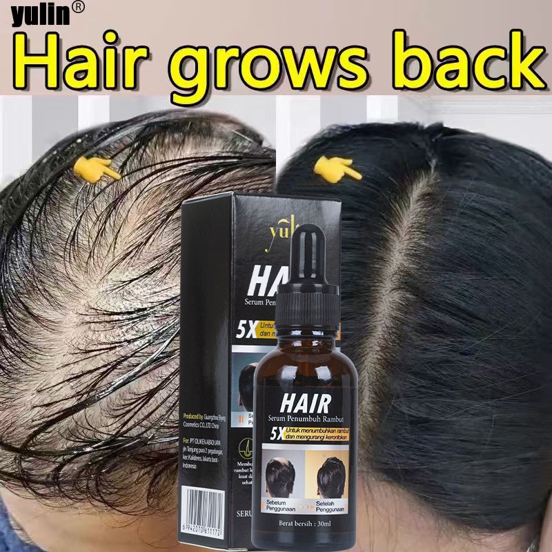 yulin Serum penumbuh rambut Obat untuk rambut penumbuh rambut serum penumbuh rambut hair serum rambu