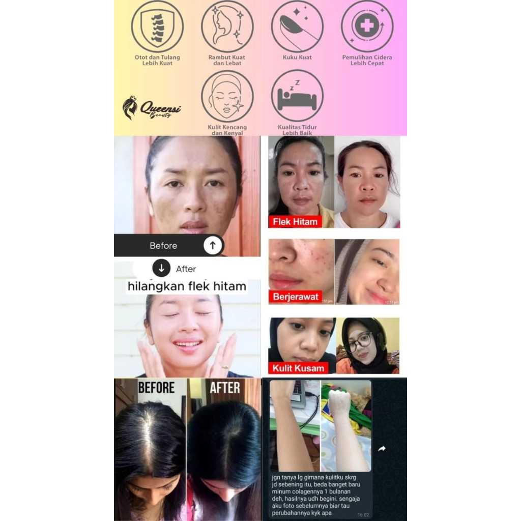 Paket 10 Box queensi collagen+queensi collagen pemutih+queensi collagen original 100%