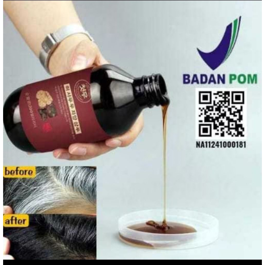 SHAMPO UBAN PALING AMPUH ATASI MASALAH RAMBUT BERUBAN