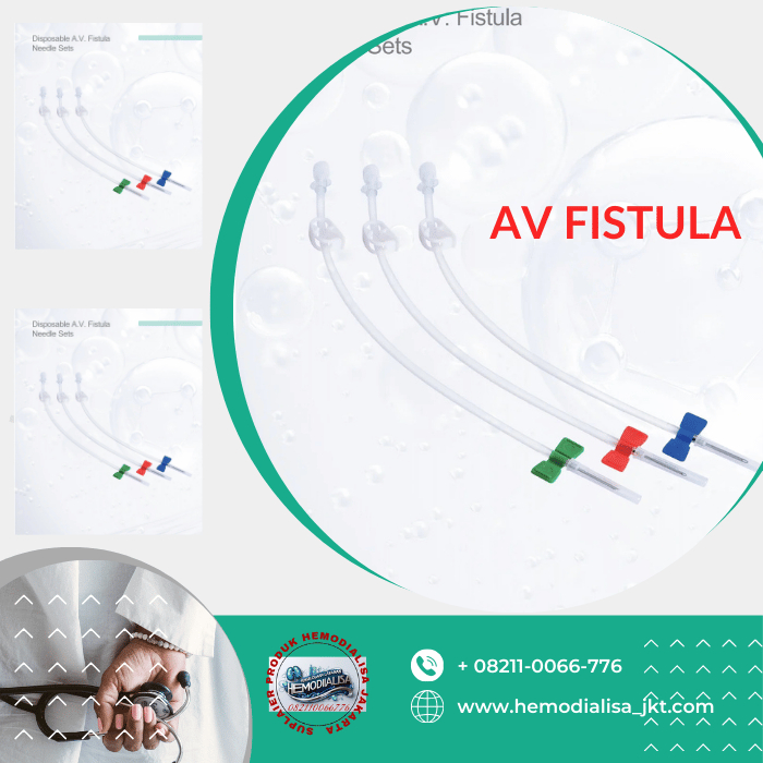 VTAL Arterial Venous Fistula Set/AV Fistula Set 16Gx25MM Fixed Wing