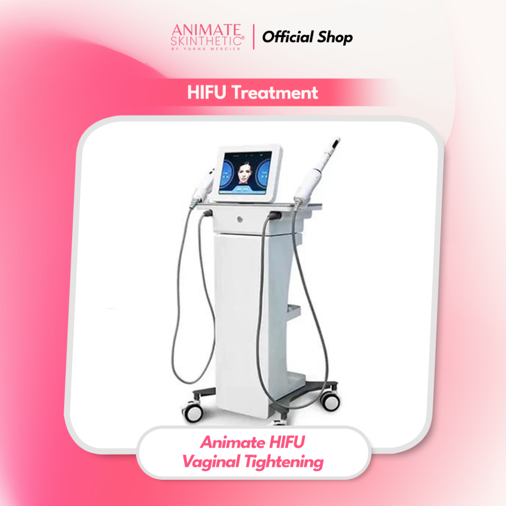 Animate HIFU - Vaginal Tightening