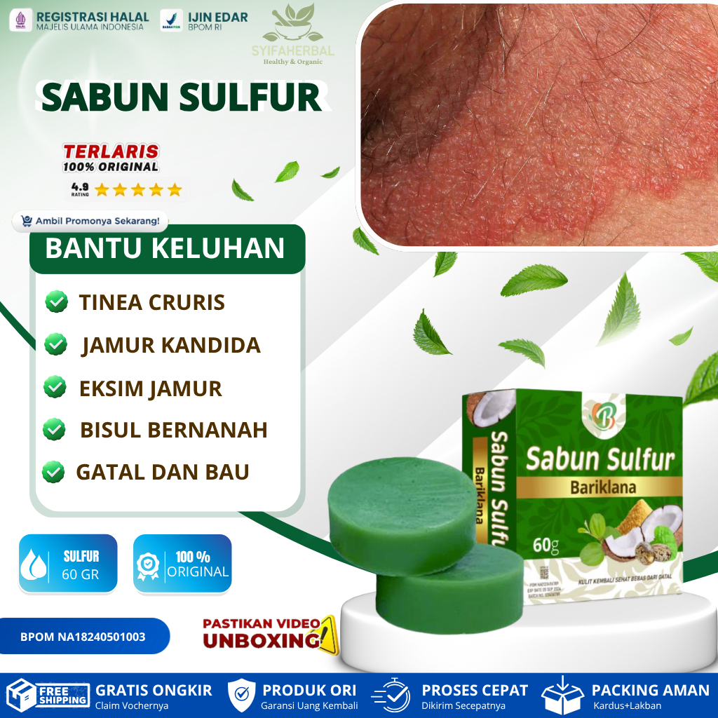 SABUN SULFUR untuk infeksi jamur kandida di lipatan kulit, tinea cruris (kurap selangkangan), eksim 